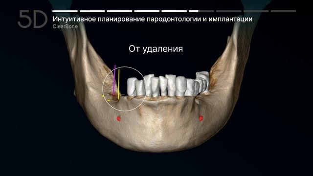 Технология 5D