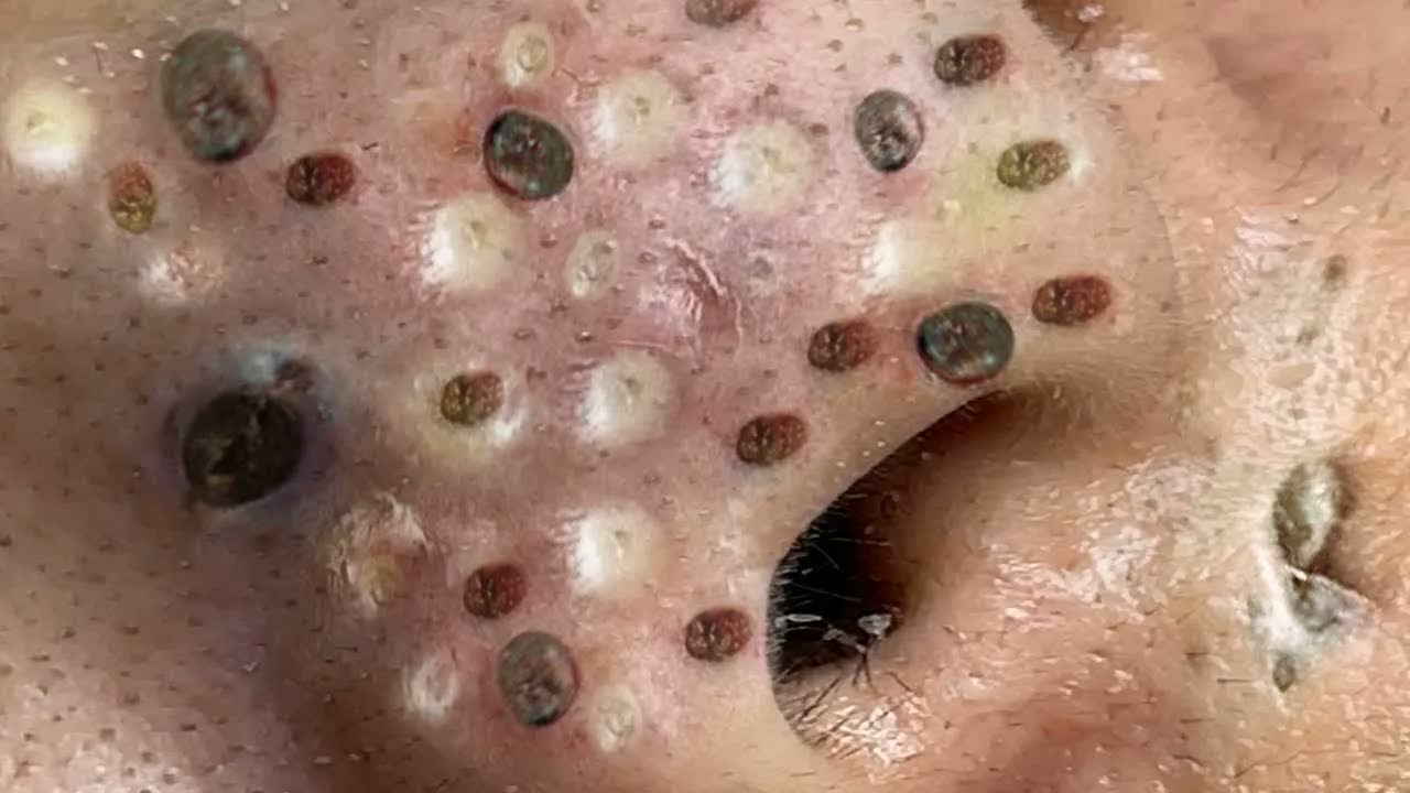 Relax Squeezing Out Blackheads #47 Черные точки