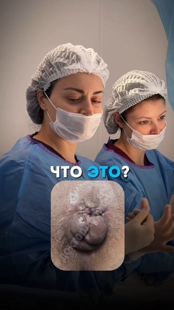 Как с таким можно ходить/жить!?  #проктолог #доктор #проктологабрицова