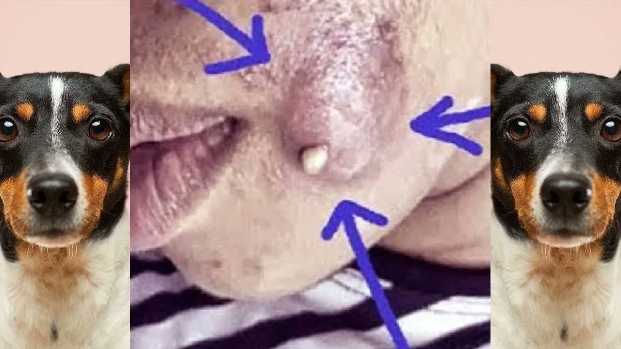 Relax Squeezing Out Blackheads #20 Черные точки