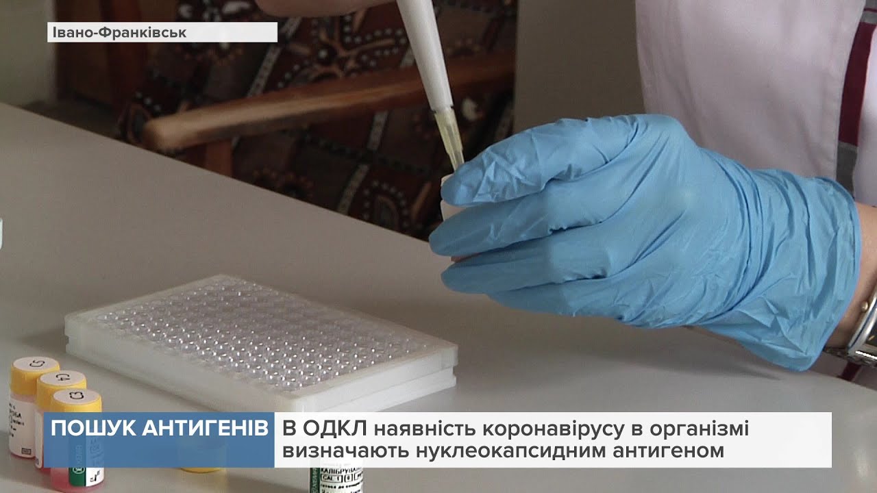 В ОДКЛ наявність коронавірусу в організмі визначають нуклеокапсидним антигеном
