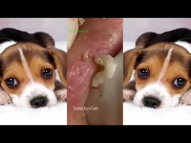 Relax squeezing out blackheads 63 Черные точки