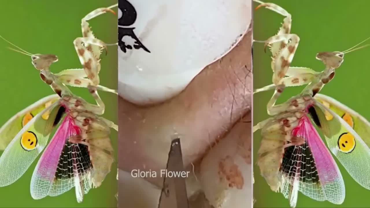 Relax Squeezing Out Blackheads #64 Черные точки
