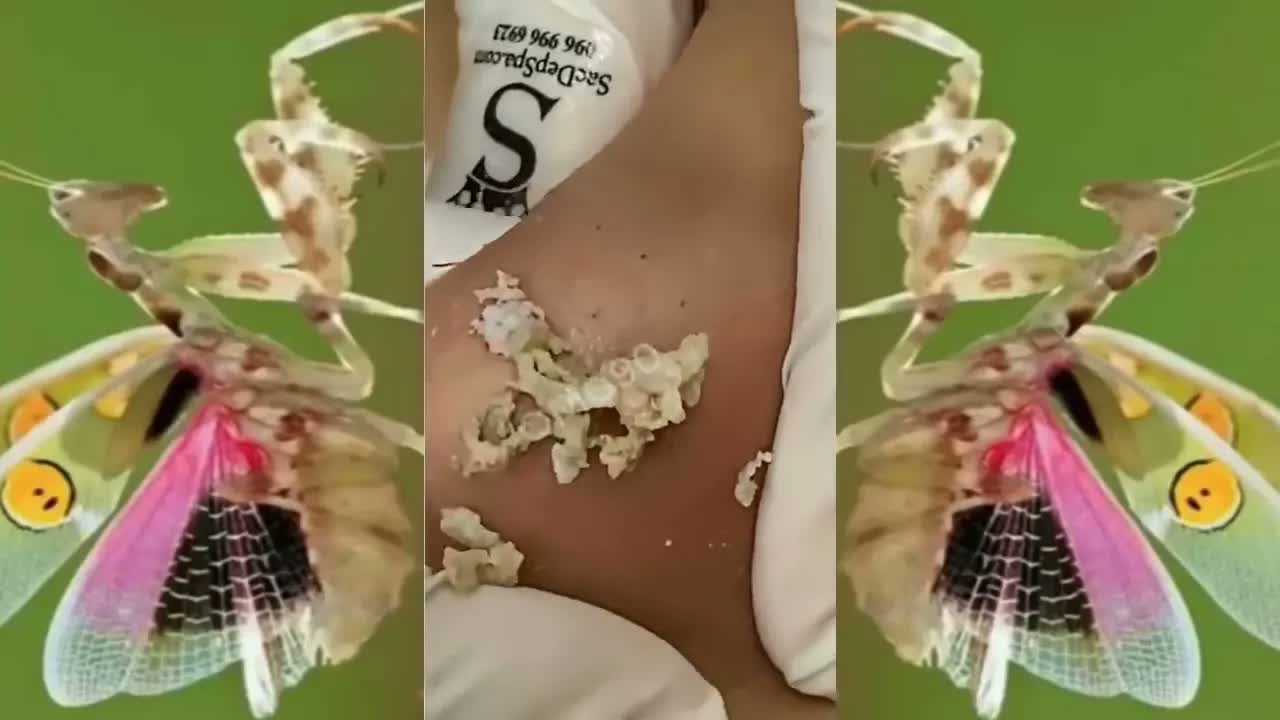 Relax Squeezing Out Blackheads #37 Черные точки