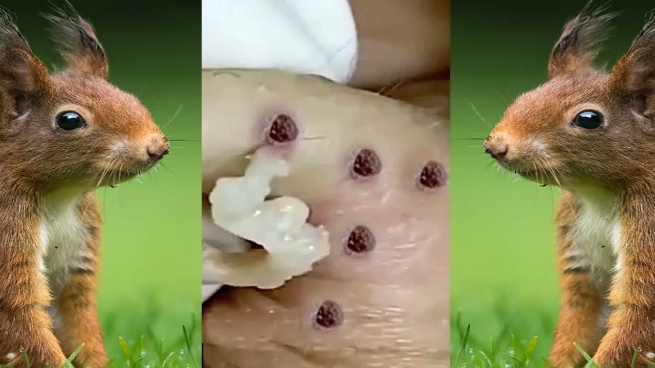 Relax Squeezing Out Blackheads #24 Черные точки