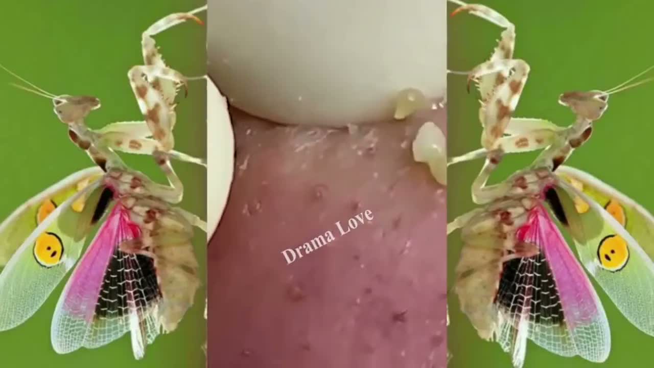 Relax Squeezing Out Blackheads #54 Черные точки