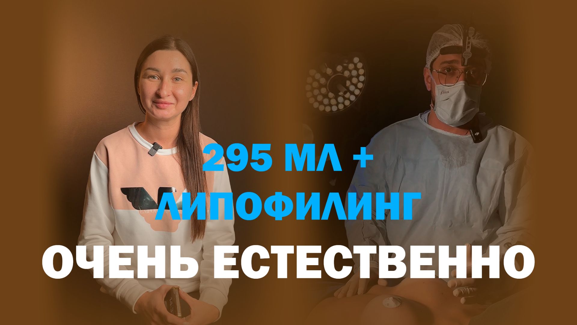 Анатомические импланты 295 мл и липофилинг груди: естественный результат