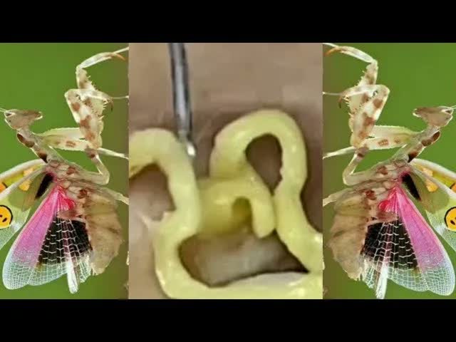 Relax Squeezing Out Blackheads #45 Черные точки