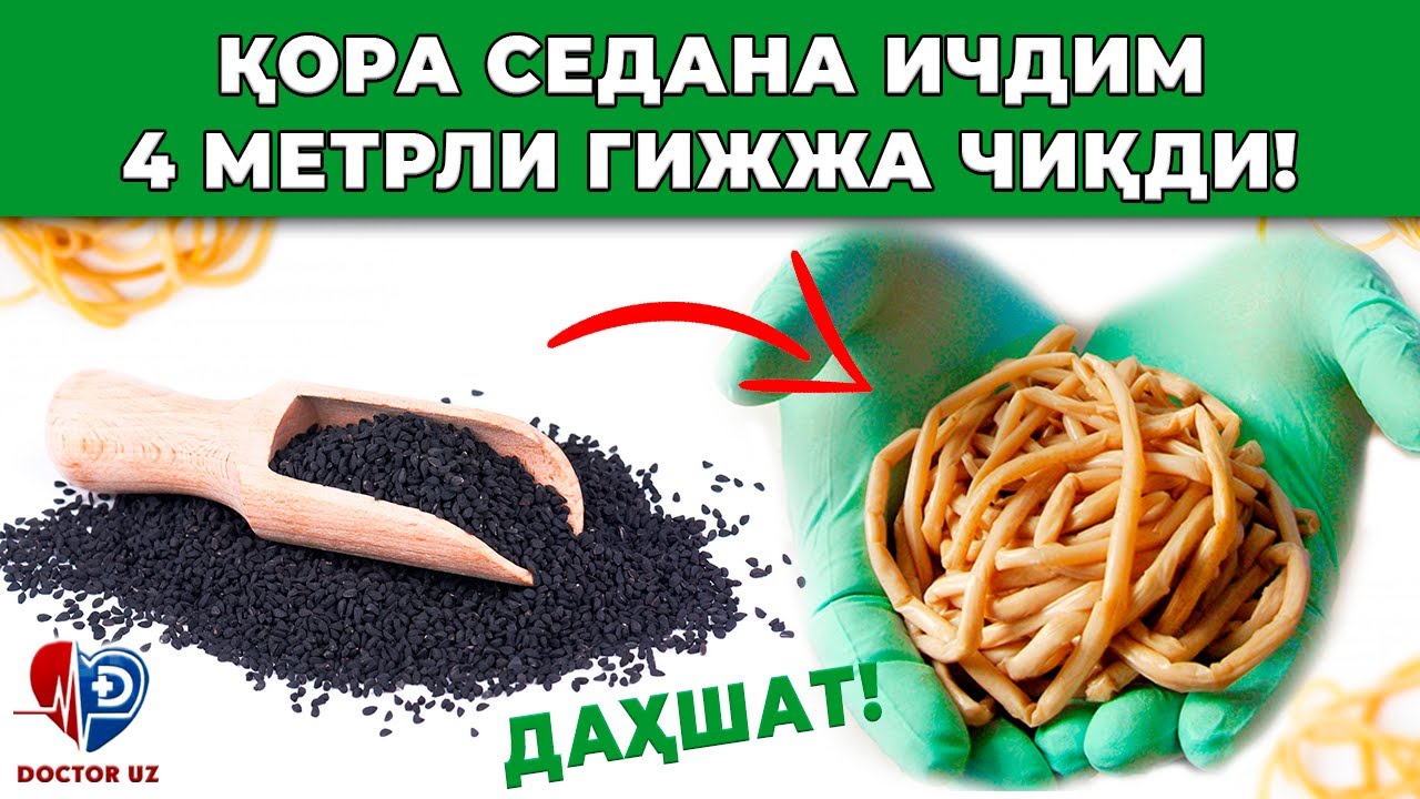 ҚОРА СЕДАНА ИЧДИМ ИЧИМДАН 4 МЕТРЛИ ГАЖЖА ЧИҚДИ! ШИФОКОРЛАР ШОКДА!