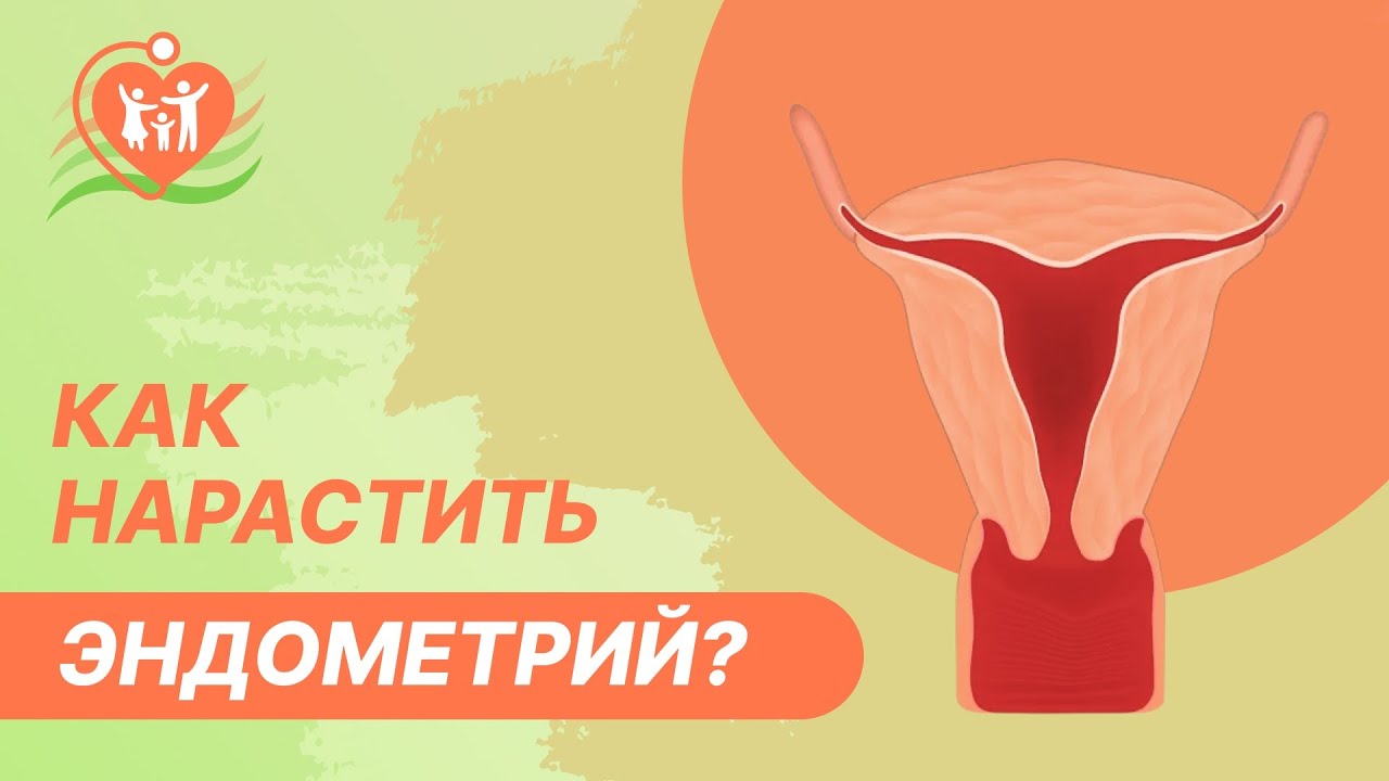  Тонкий эндометрий. Как нарастить эндометрий?