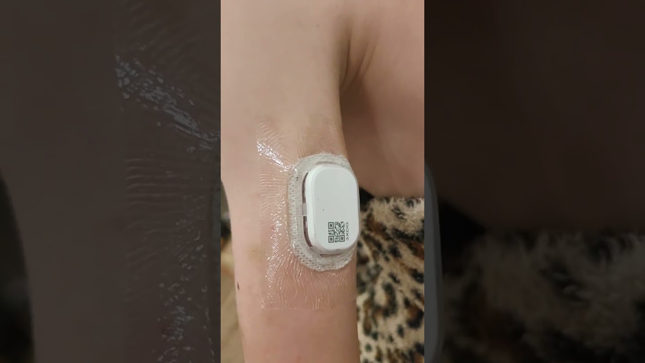 Сибионикс 2, сиби 2, Sibionics Gs1 P2, обзор и небольшая инструкция.