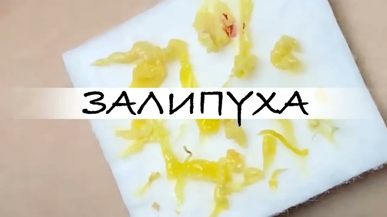 ПРЫЩИ ВЫДАВЛИВАНИЕ   ПОДБОРКА ВЫДАВЛИВАНИЕ ПРЫЩЕЙ прыщи acne asmr