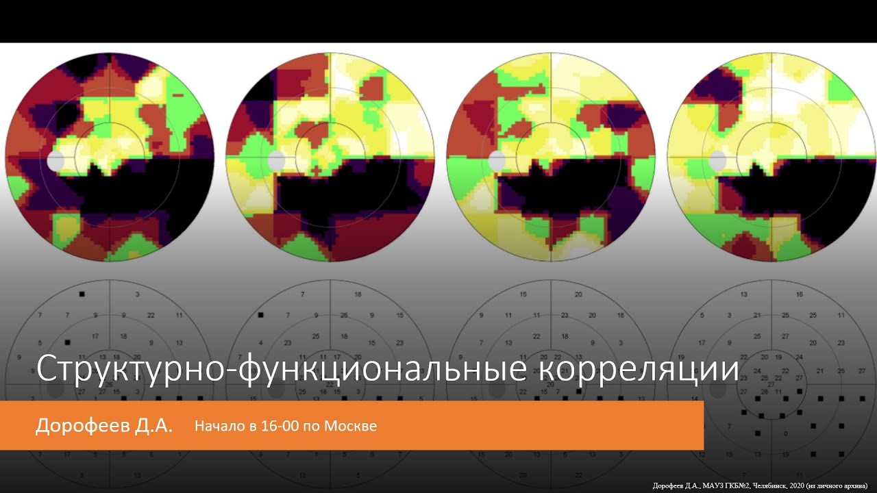 Погружение в периметрию Структурно функциональные корреляции 7/7