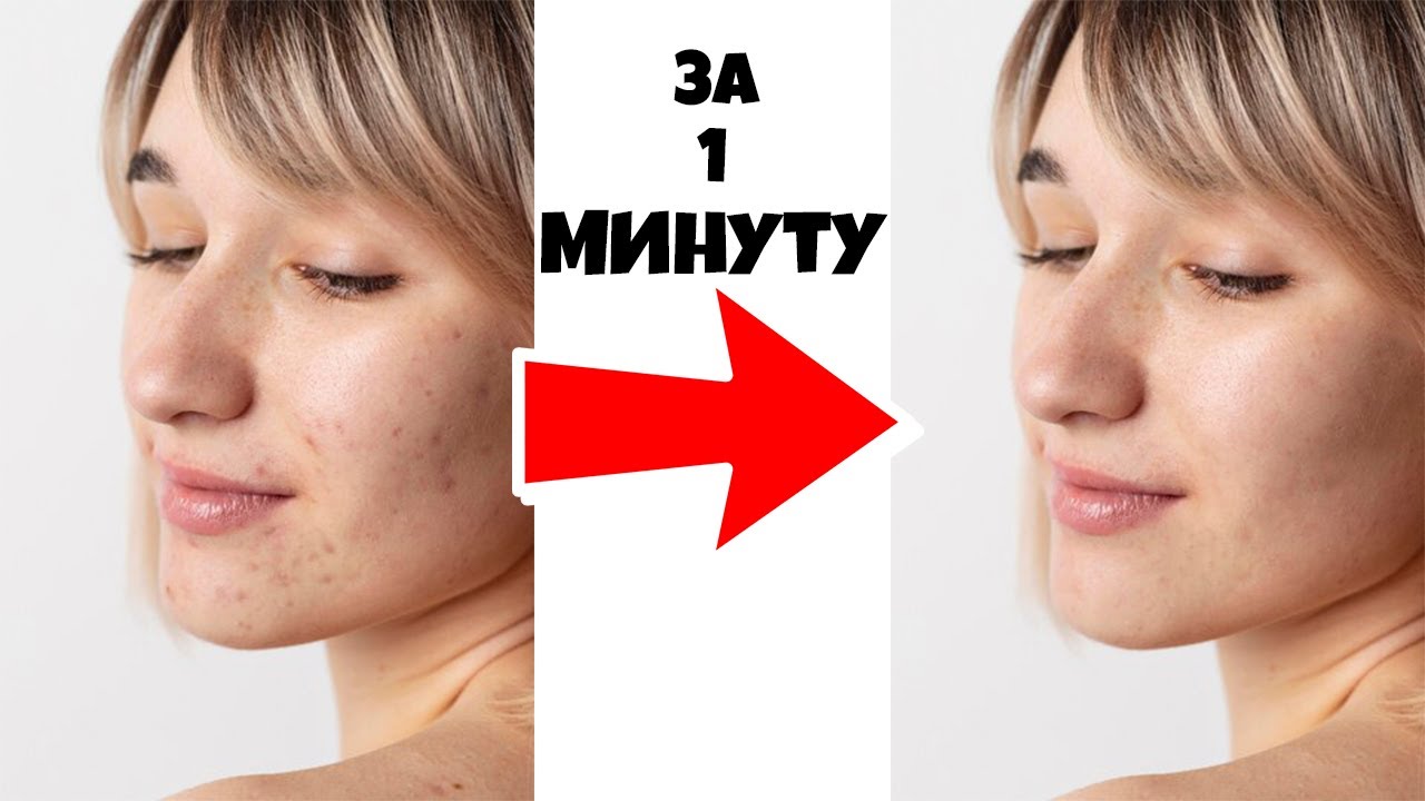 КАК УБРАТЬ ПРЫЩИ В ФОТОШОПЕ ЗА 1 МИНУТУ