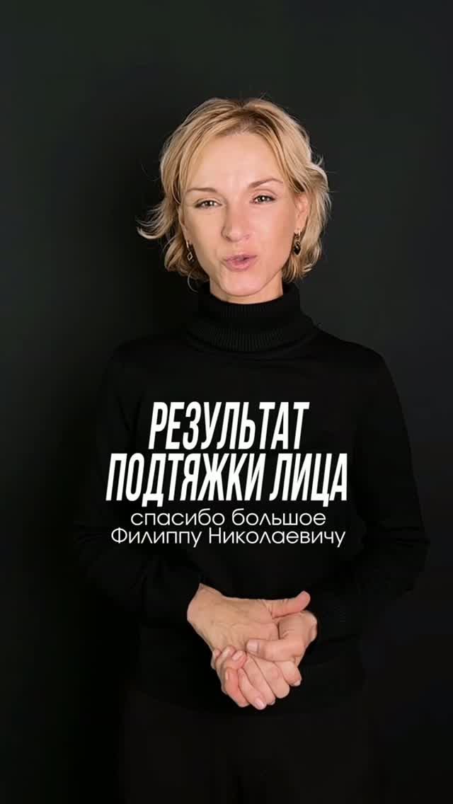 Подтяжка лица Deep Plane через 6 месяцев