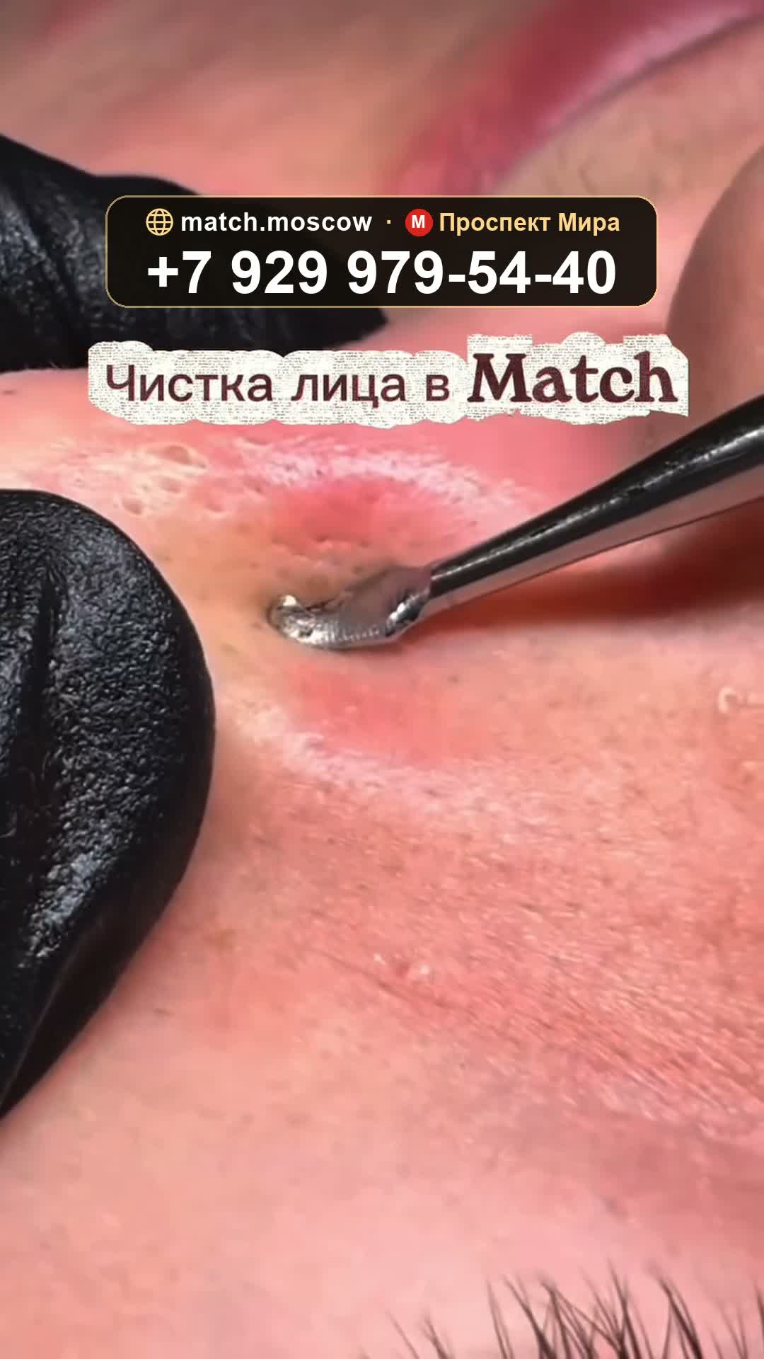 Чистка лица механическая vs ультразвуковая: для каких типов кожи подходит каждый метод