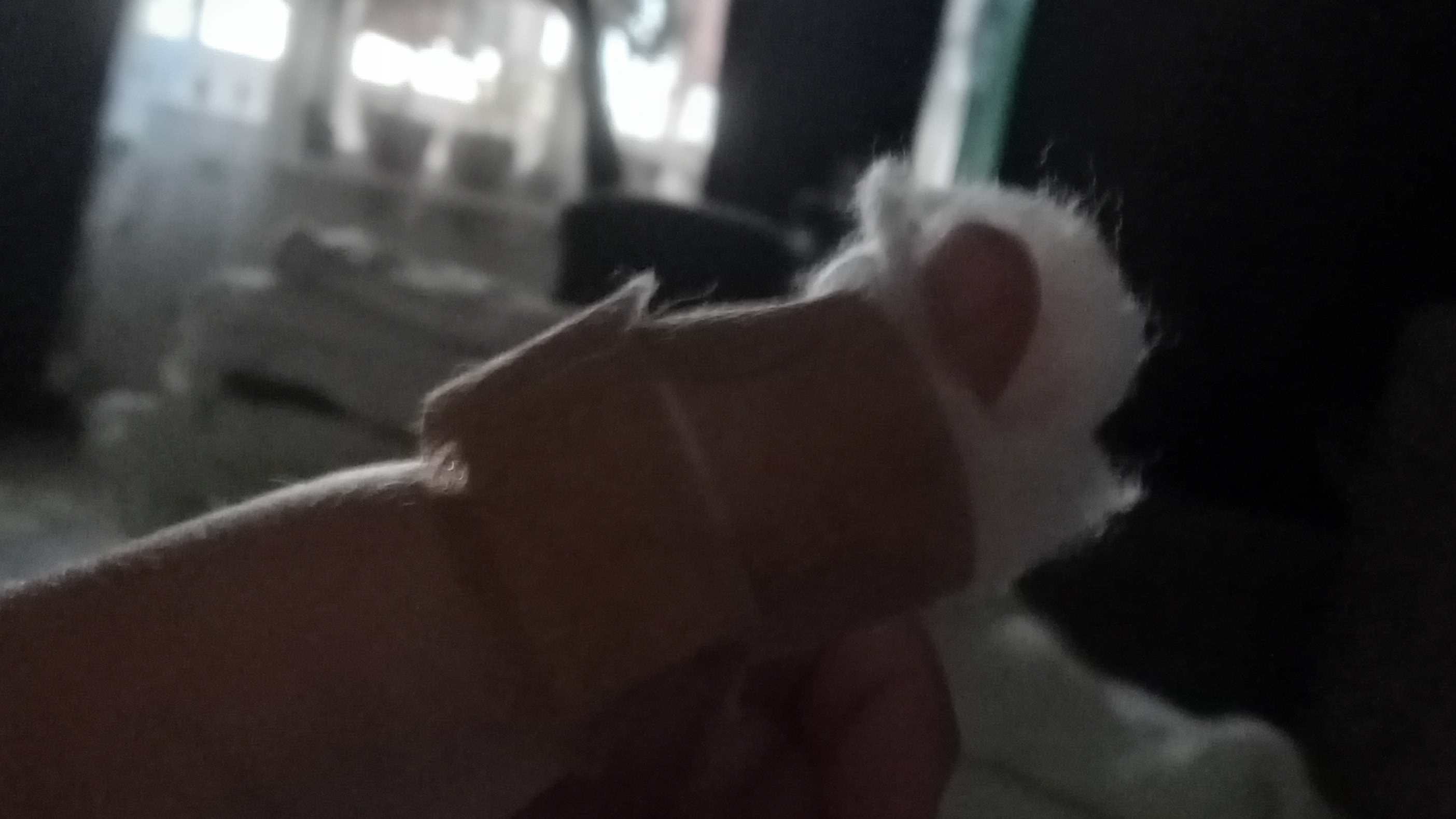 мне бабушка случайно сломала палец из-за того что мы играли