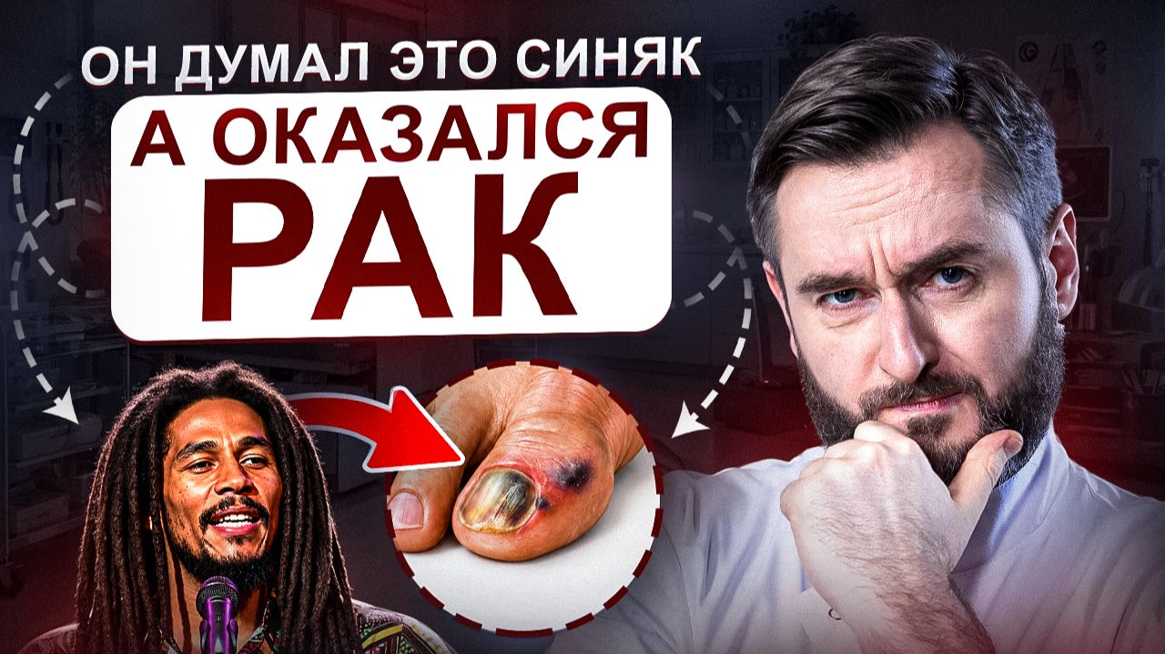 ДИАГНОСТИКА РАКА