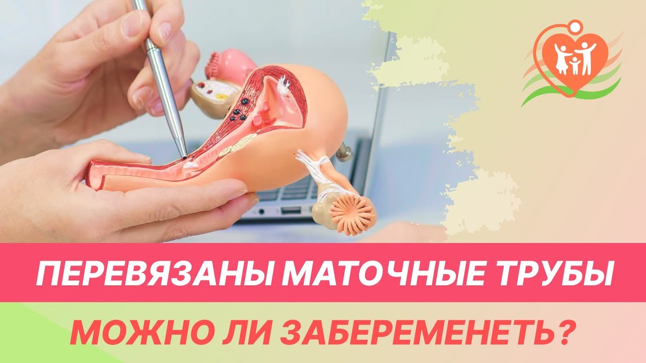 💁♀️ Перевязаны маточные трубы - можно ли забеременеть?