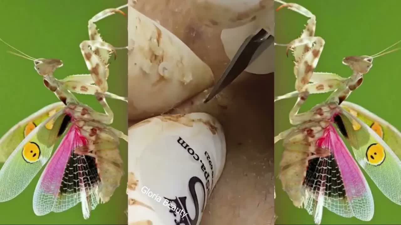 Relax squeezing out blackheads 19 Черные точки
