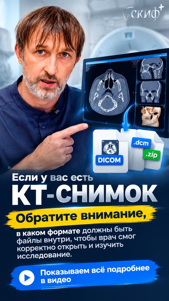 Компьютерная томография