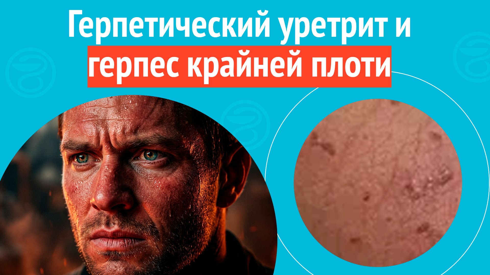 Дерматология