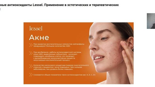 LESSEL
