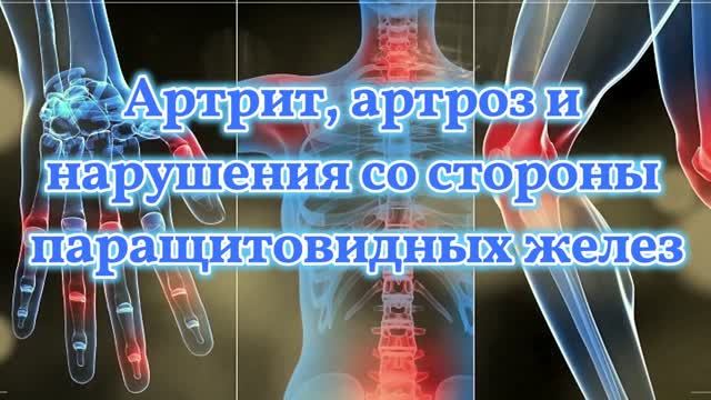 Артрит, Артроз и Нарушения со Стороны Паращитовидных Желез, Влияющие на Метаболизм Кальция