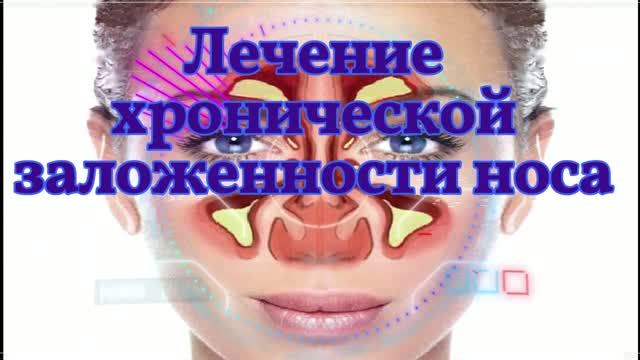 Лечение Хронической Заложенности Носа*Разблокировка Носа*Прочистить Нос*Бинауральные ритмы