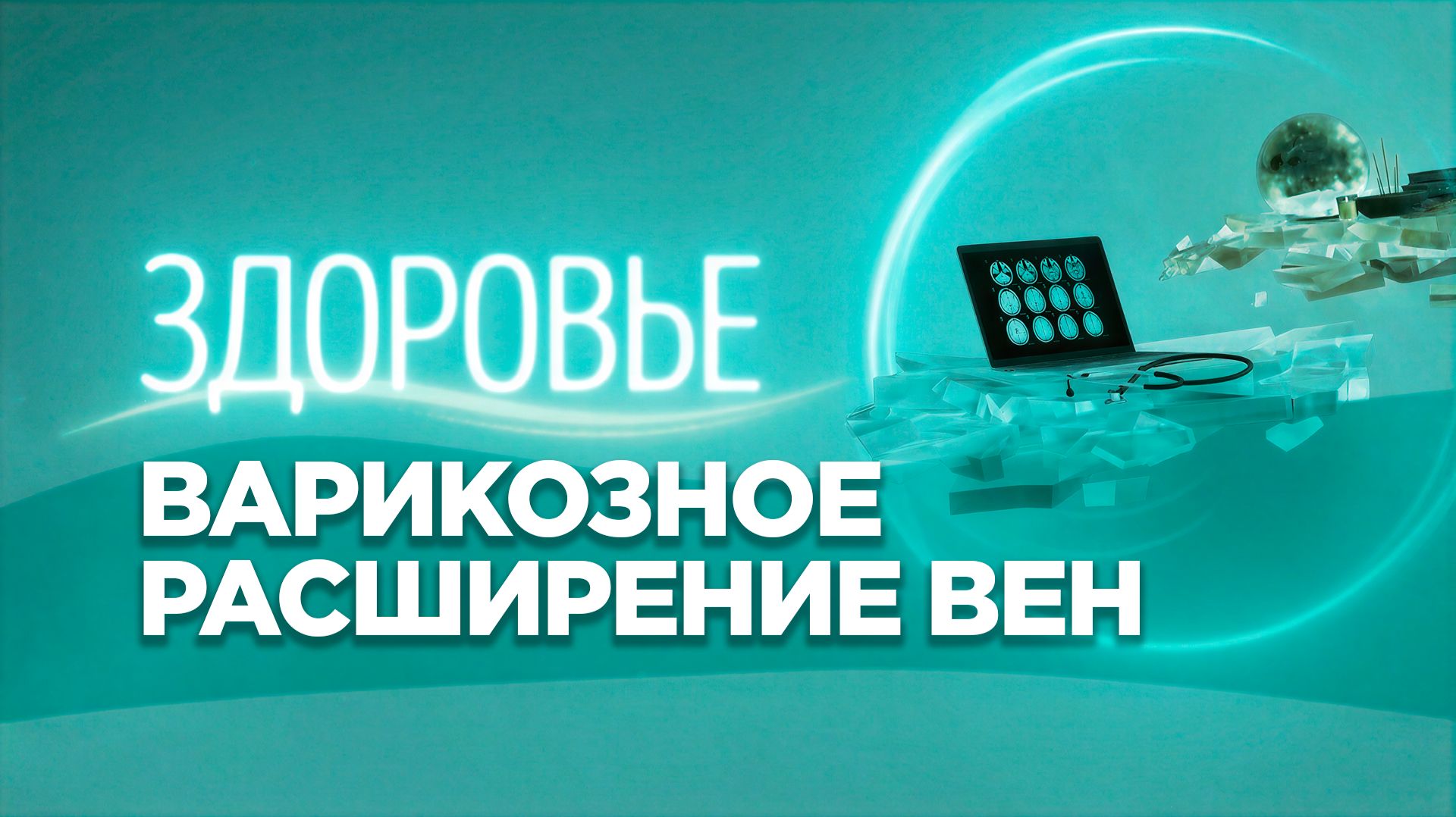 Варикозное расширение вен | Современные методы лечения