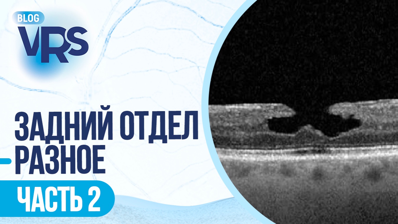 Сезон 7