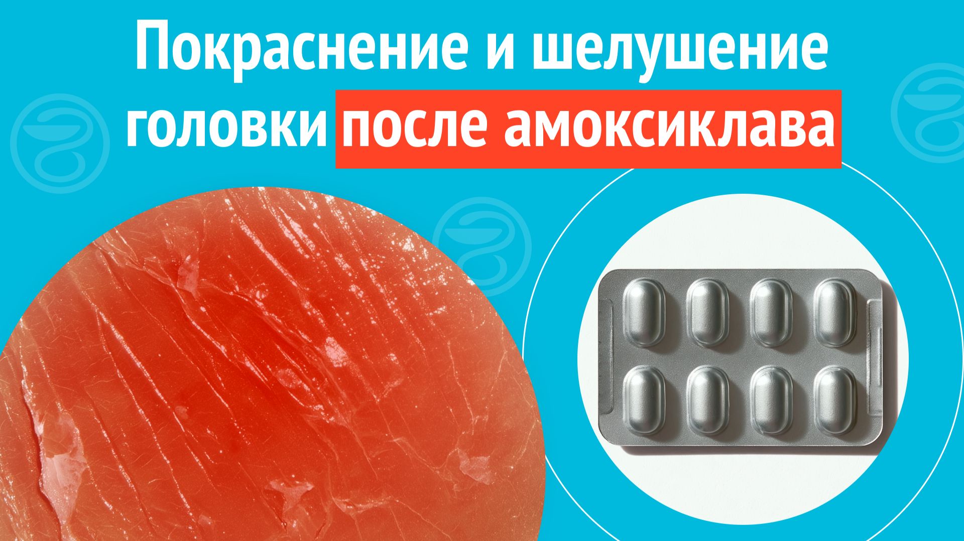 Клинические случаи