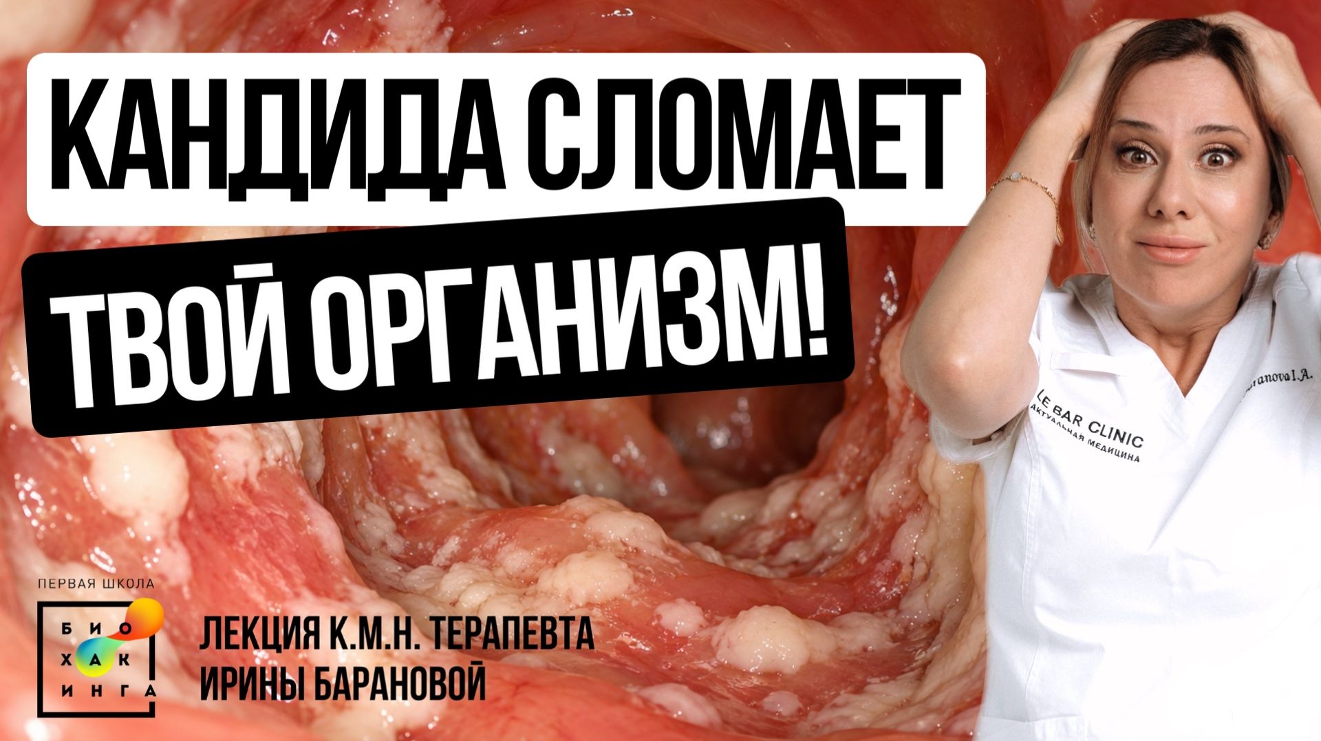 Кандида и паразиты 10.25
