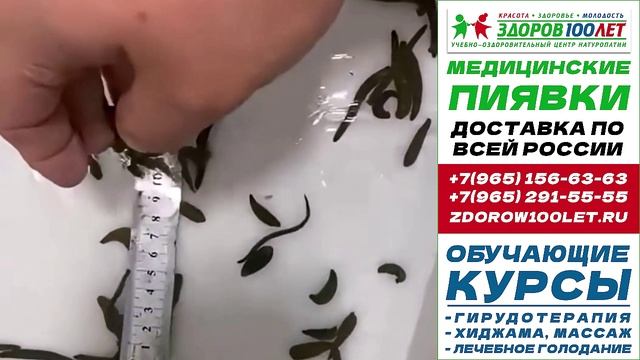 Пиявки медицинские купить в москве. Лечебные пиявки для гирудотерапии.