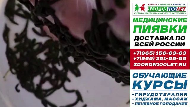 Пиявки медицинские купить в москве. Лечебные пиявки для гирудотерапии.