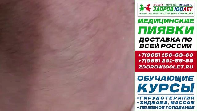 Пиявки медицинские купить в москве. Лечебные пиявки для гирудотерапии.