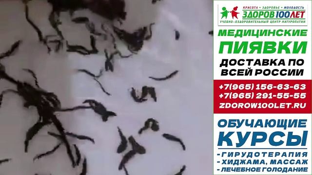 Пиявки медицинские купить в москве. Лечебные пиявки для гирудотерапии.