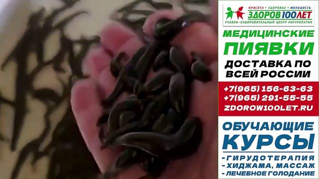 Пиявки медицинские купить в москве. Лечебные пиявки для гирудотерапии.