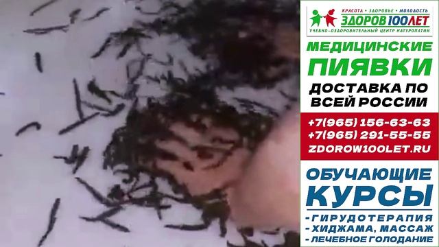 Пиявки медицинские купить в москве. Лечебные пиявки для гирудотерапии.