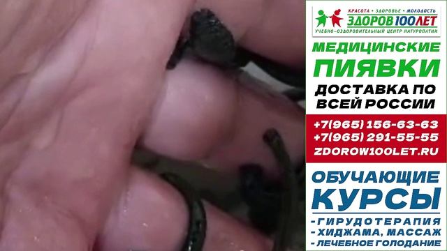 Пиявки медицинские купить в москве. Лечебные пиявки для гирудотерапии.