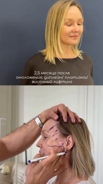 Пластическая хирургия