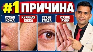 СУХАЯ КОЖА (КУРИНАЯ КОЖА). ПРИЧИНЫ И ЛЕЧЕНИЕ.