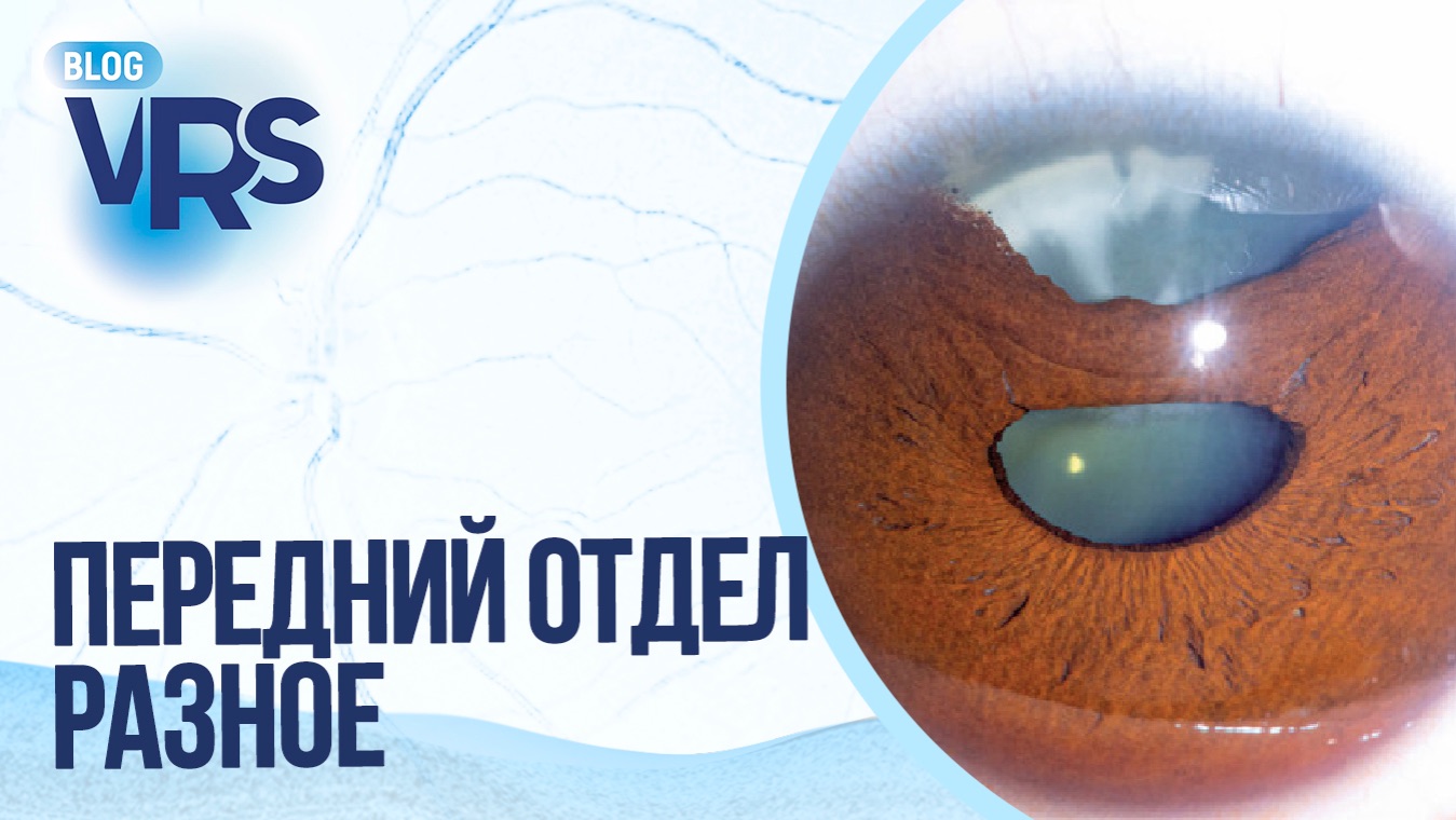 Сезон 7