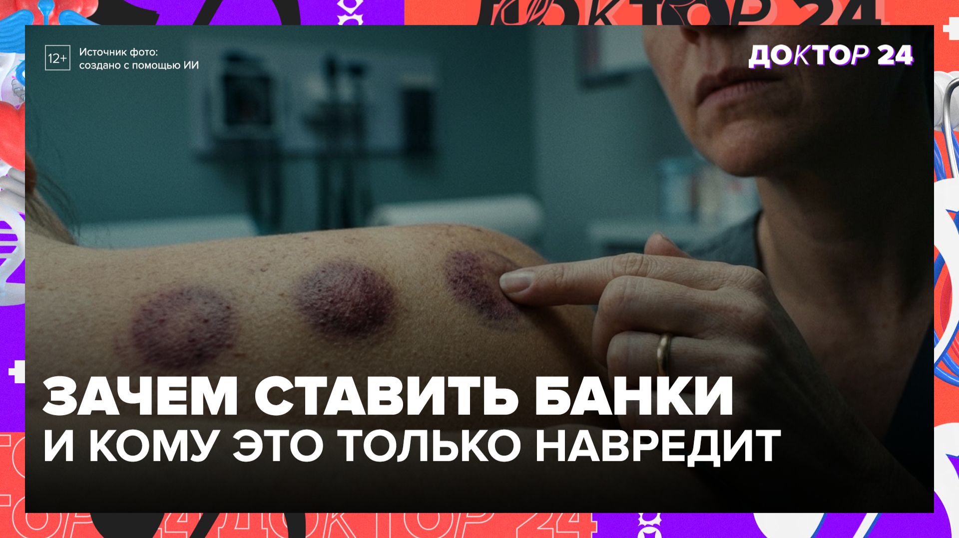 Ставить банки на спину — способ укрепить здоровье или бесполезный тренд? Объясняет врач | Доктор 24