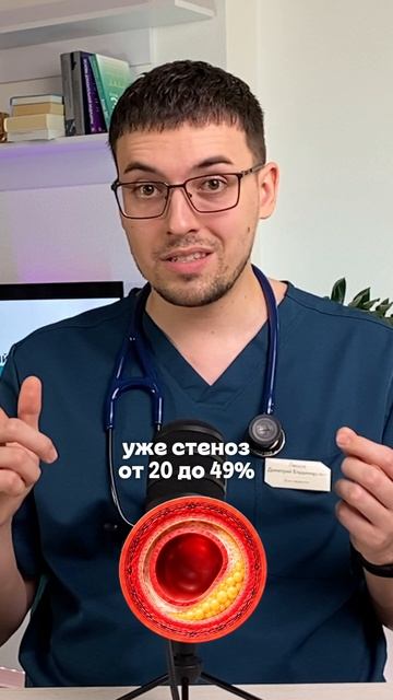 Нашли бляшку на УЗИ артерий шеи. Как понять, насколько бляшка опасна развитием инсульта?