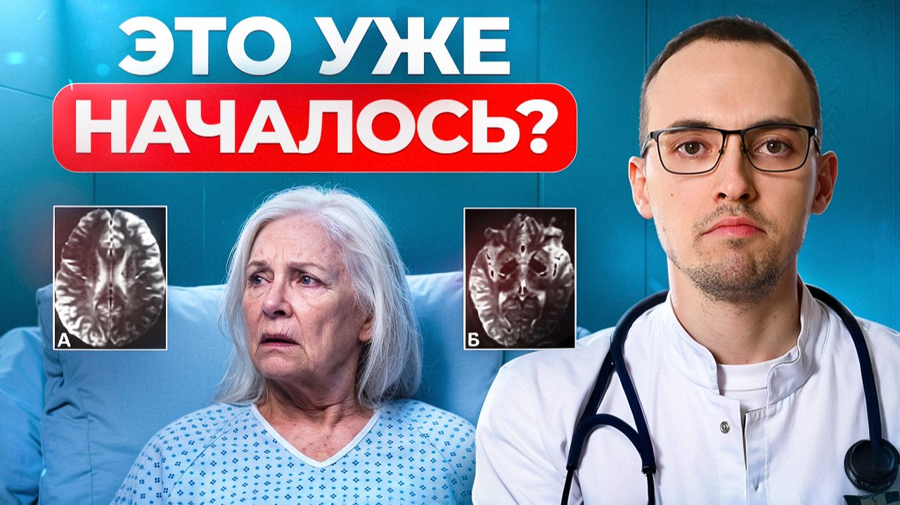 ДЕМЕНЦИЯ: 7 первых признаков, которые замечают слишком поздно