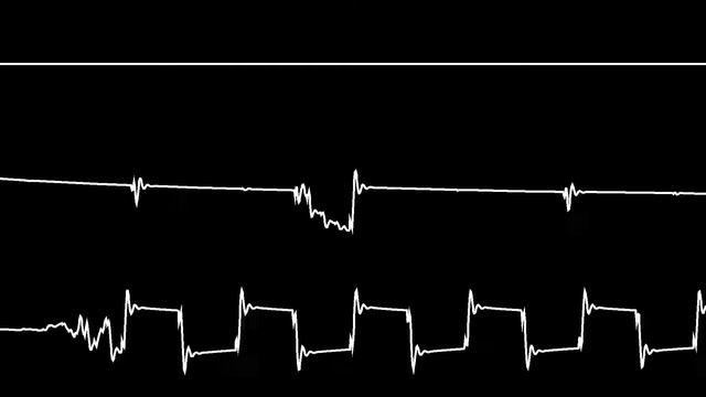 COMMODORE C64 SID - 2020 - FRESH KOOL - CHRIS-DO / Oscilloscope View - Cover - Chiptune смотреть онлайн