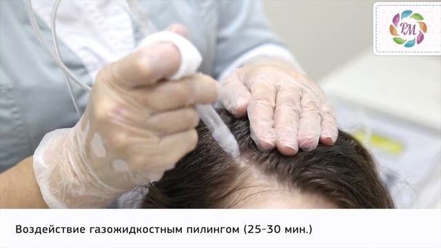 Газожидкостный пилинг кожи головы  Процедура Роял Медик