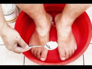 Замучил грибок, потеют ноги? Есть выход. Простой и эффективный способ.