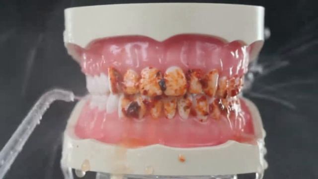 AQ-300 Oralni irigator смотреть онлайн